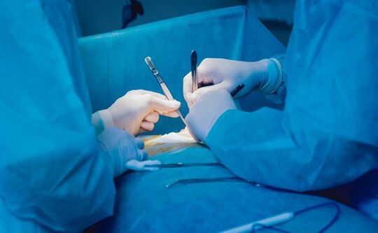 Performing a penis enlargement surgery